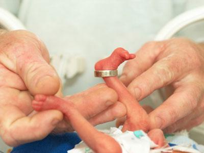 Leia mais sobre o artigo Vamos compreender algumas especificidades dos bebês prematuros?